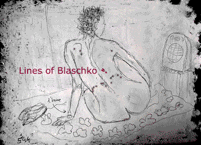 Lines of Blaschko